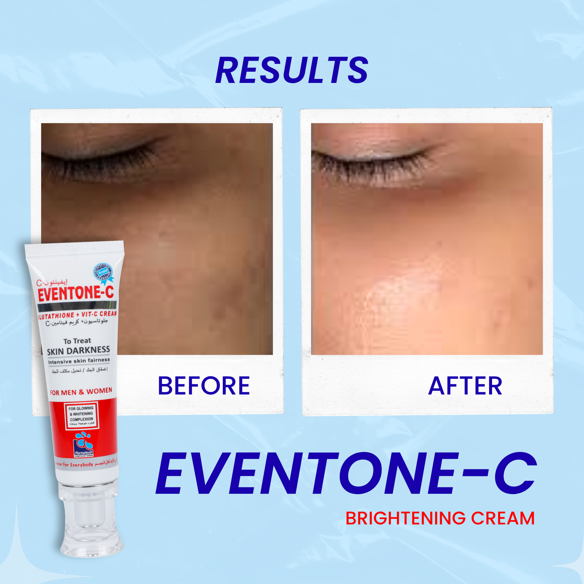 Eventone C Cream (Skin Glowing)